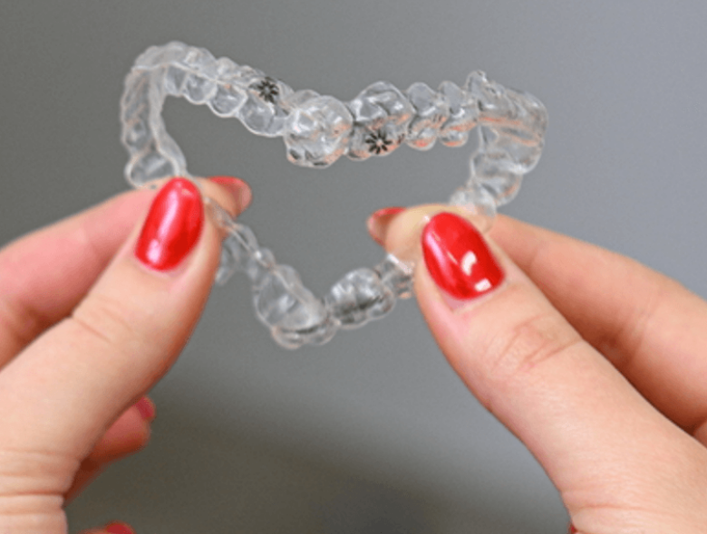 Esztétikai fogszabályozás