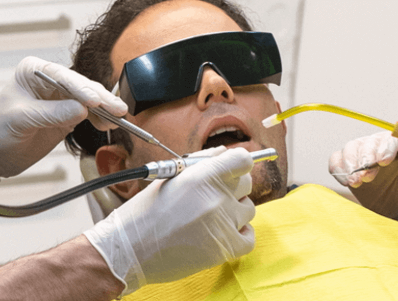 Melyik implantátum típust, márkát válasszam?