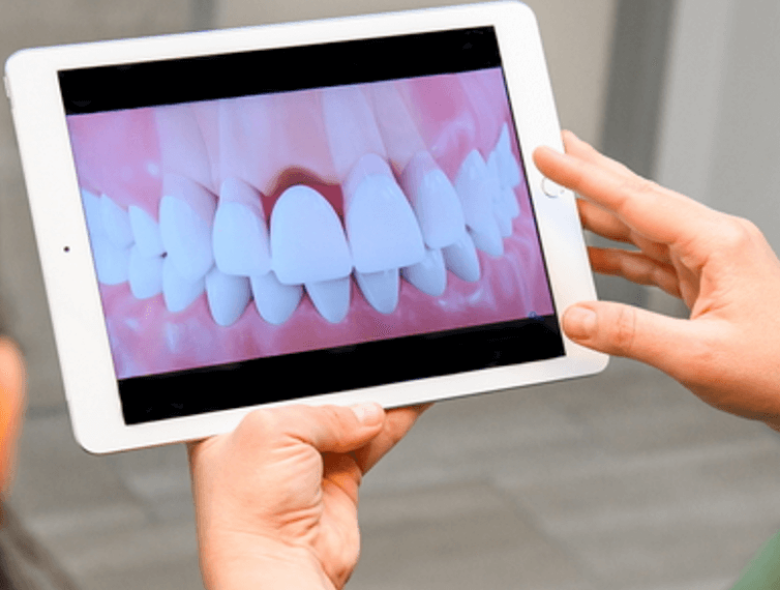 Fogínysorvadás: megelőző lépések, tünetek és gyógyítás