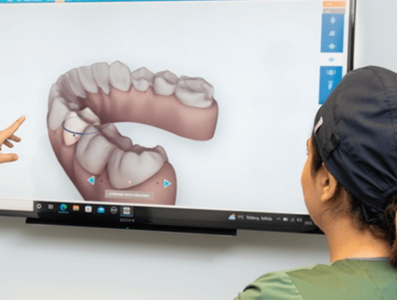 Fogpótlás: melyik típust milyen helyzetben javasoljuk?