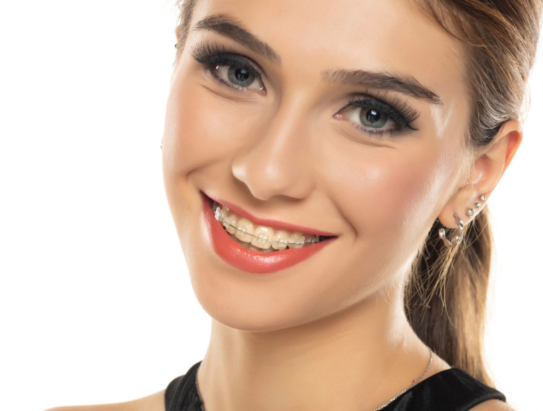 Fogszabályozás árak: teljes útmutató a költségekről és a típusokról