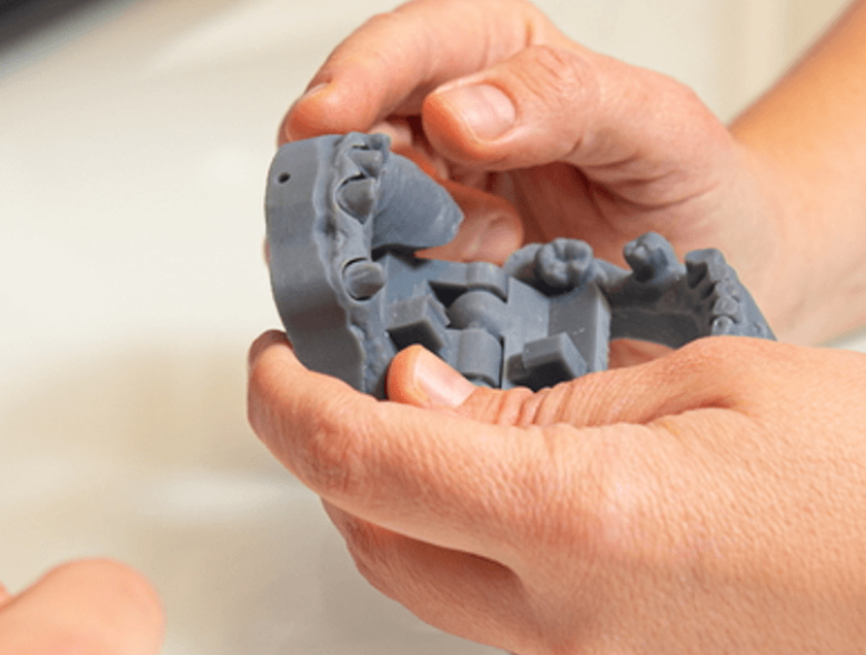 Hiányzó fog pótlása fixen és stabilan