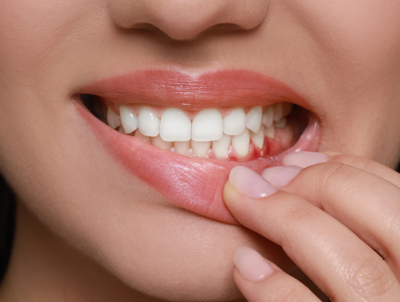 Ínysorvadás vagy fogínygyulladás?