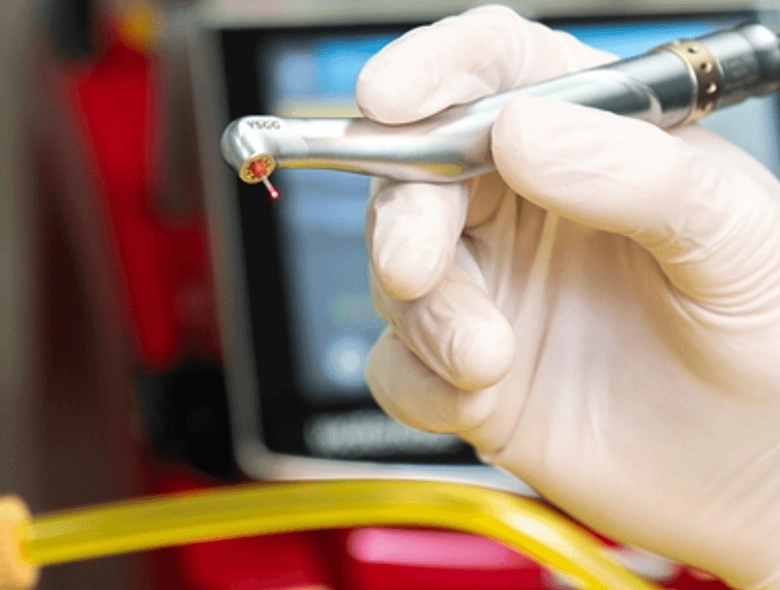 Laser dental treatments