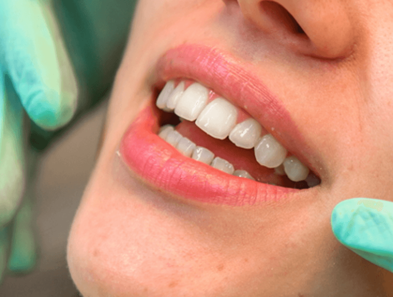 LED light teeth whitening