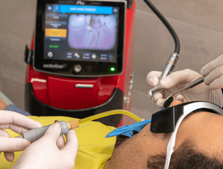 Root canal treatment with laser