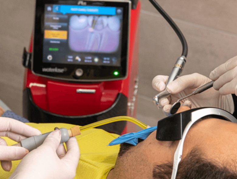 Saving infected teeth – root canal treatment