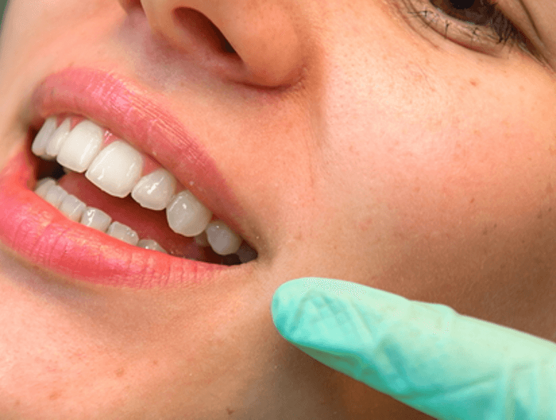 Természetes, irritációmentes fogápolás - Bilka