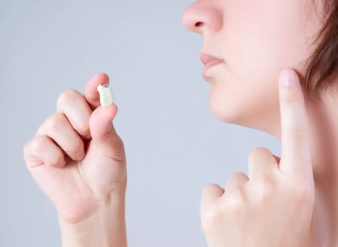Wisdom tooth extraction at the Naturadent clinic